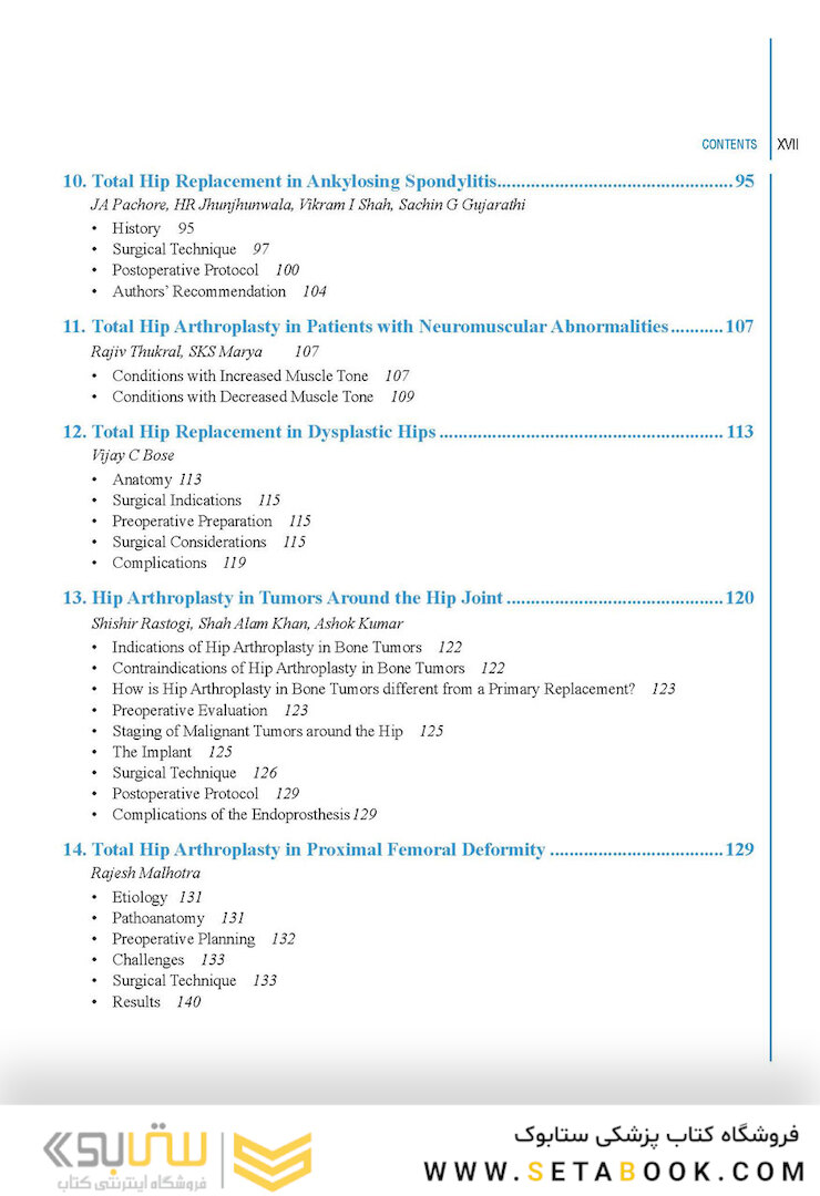Complex Primary Total Hip Replacement 1st Edition