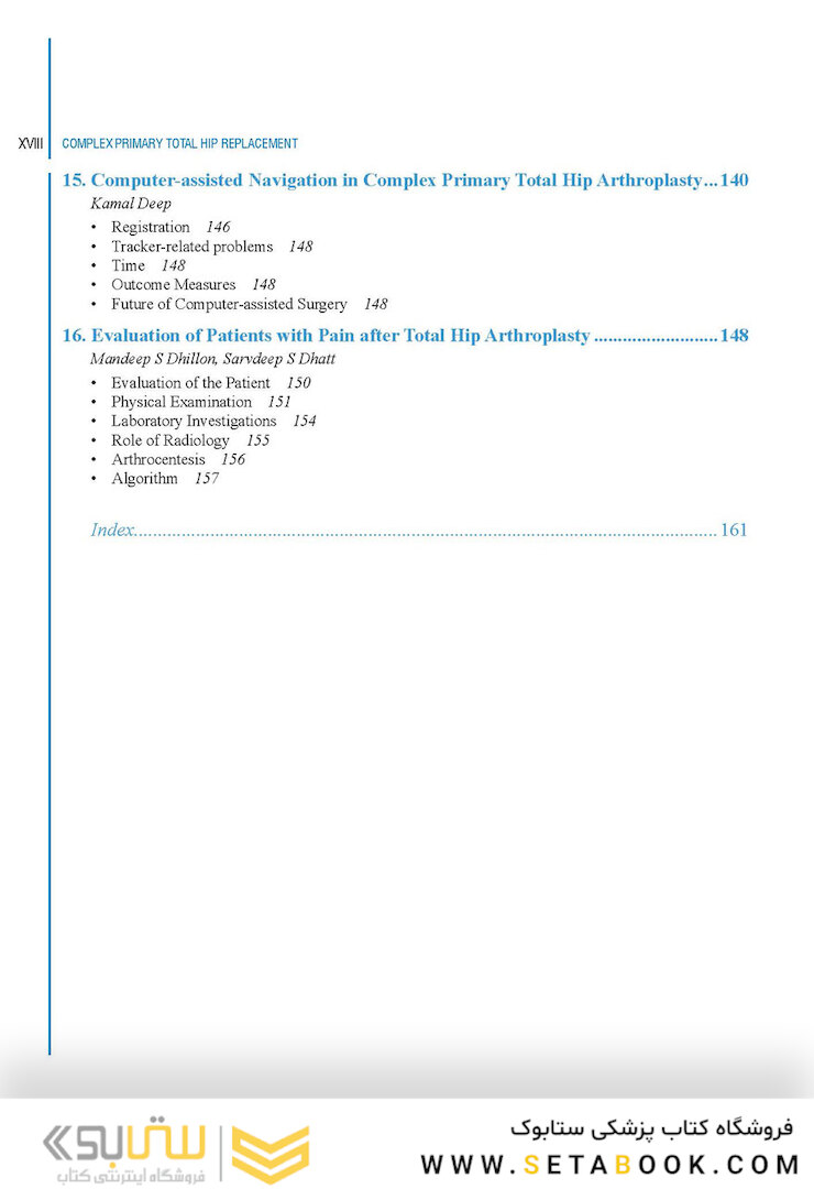Complex Primary Total Hip Replacement 1st Edition