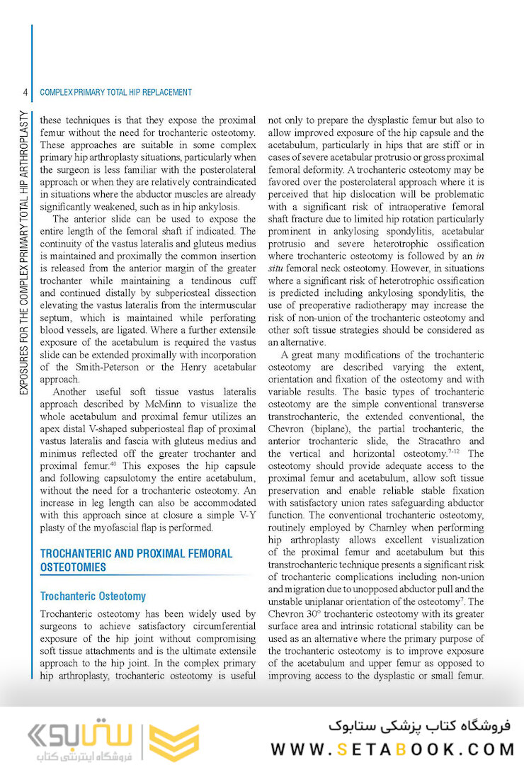 Complex Primary Total Hip Replacement 1st Edition