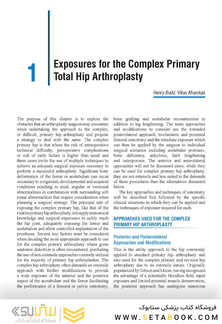 Complex Primary Total Hip Replacement 1st Edition
