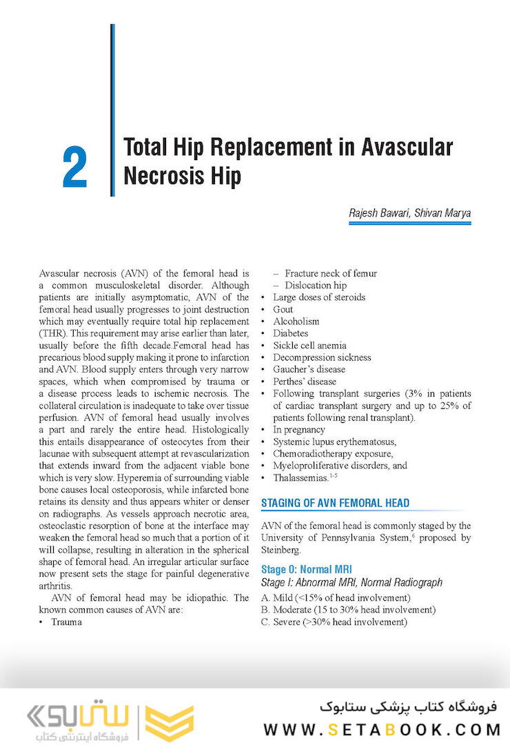Complex Primary Total Hip Replacement 1st Edition