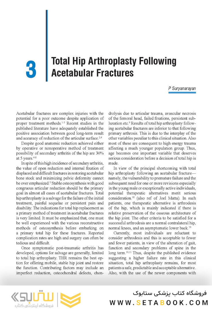Complex Primary Total Hip Replacement 1st Edition