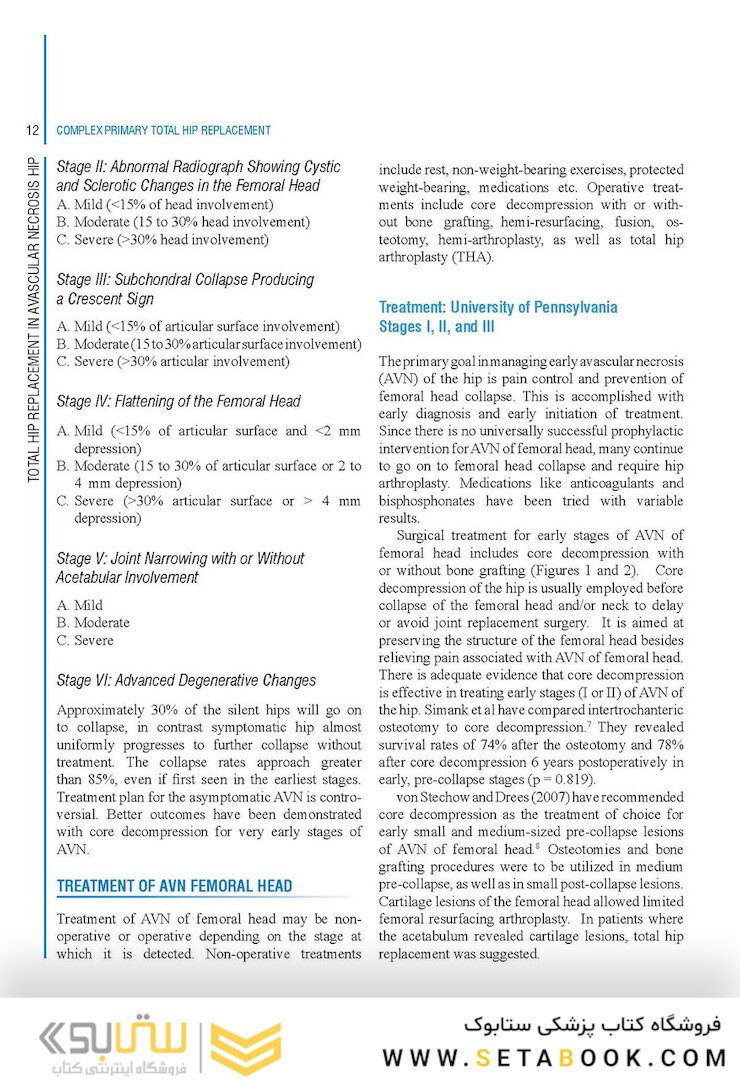 Complex Primary Total Hip Replacement 1st Edition