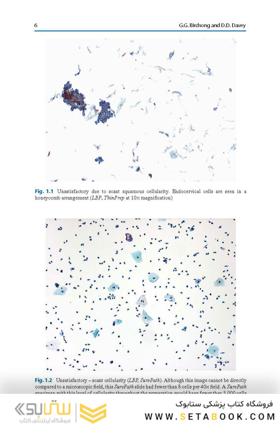 The Bethesda System for Reporting Cervical Cytology, 3rd Edition 2015