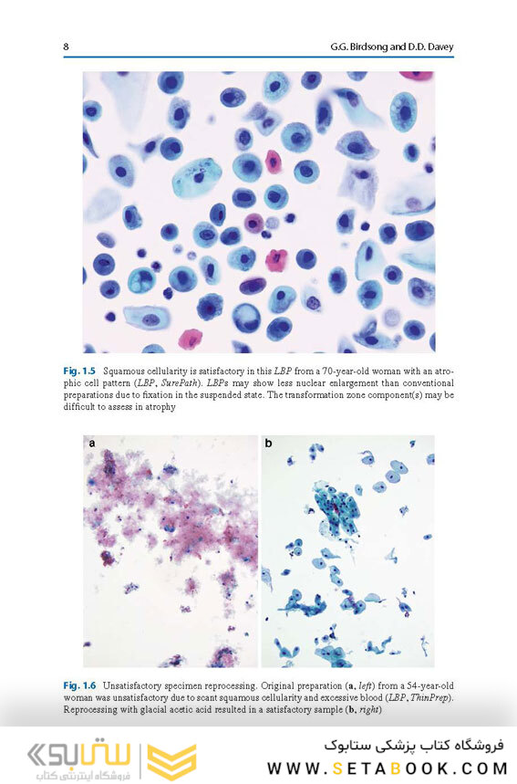 The Bethesda System for Reporting Cervical Cytology, 3rd Edition 2015