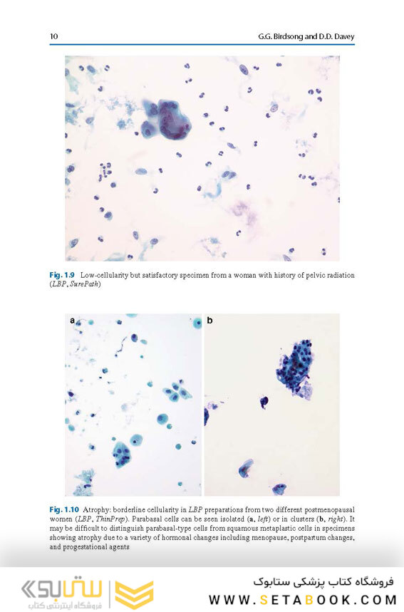 The Bethesda System for Reporting Cervical Cytology, 3rd Edition 2015