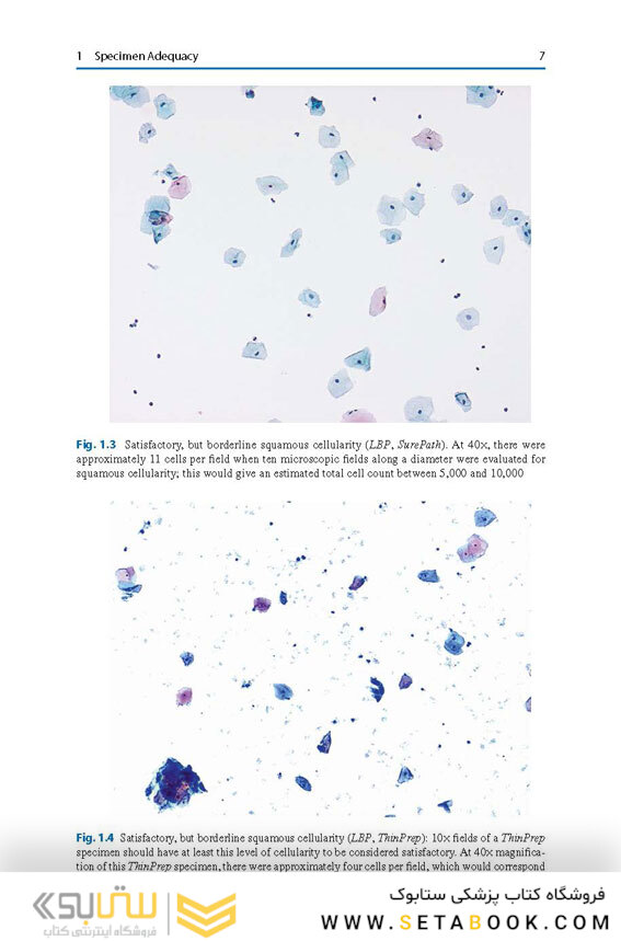 The Bethesda System for Reporting Cervical Cytology, 3rd Edition 2015