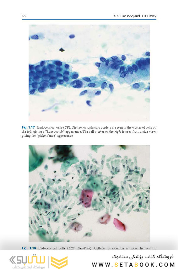 The Bethesda System for Reporting Cervical Cytology, 3rd Edition 2015