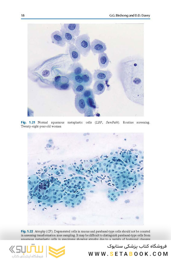 The Bethesda System for Reporting Cervical Cytology, 3rd Edition 2015