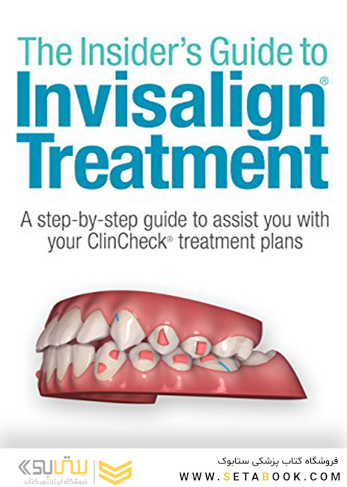 Insider’s Guide to Invisalign Treatment2018
