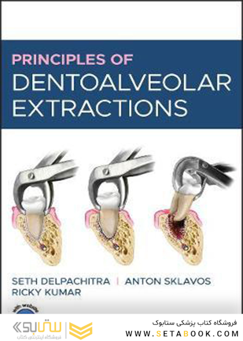Principles of Dentoalveolar Extractions2021 اصول استخراج دندان - آلوئولار