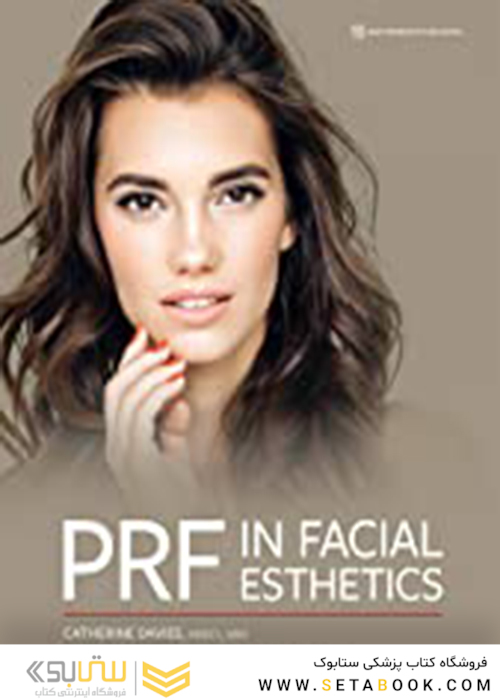 PRF in Facial Esthetics