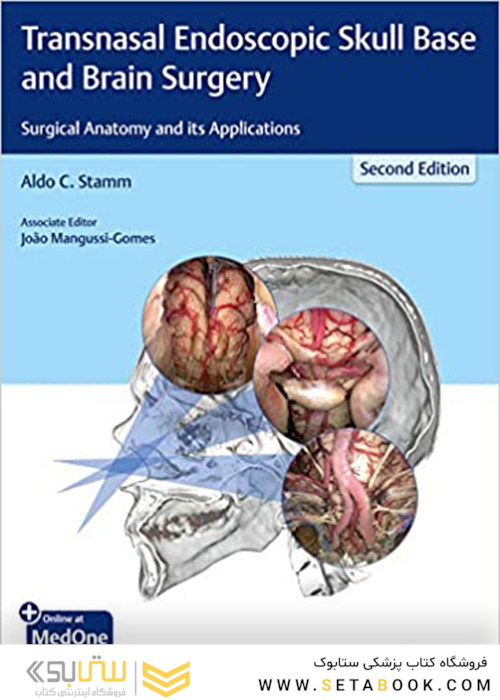 Transnasal Endoscopic Skull Base and Brain Surgery: Surgical Anatomy and its Applicationsجراحی پایه و مغز آندوسکوپی جمجمه: آناتومی جراحی و کاربردهای آن