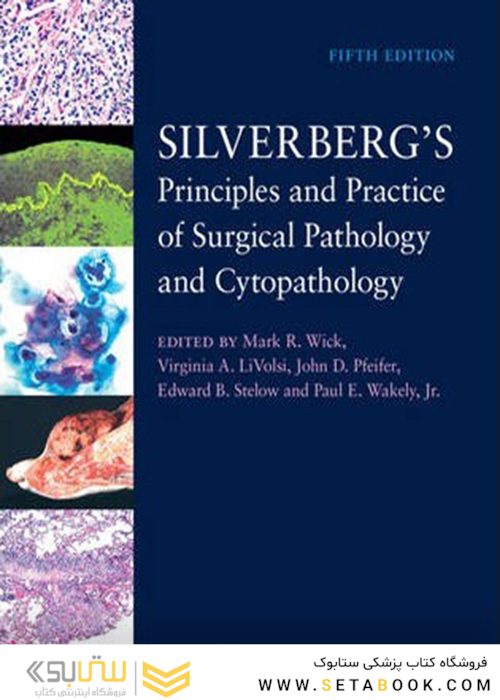 Silverberg