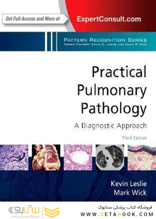 Practical Pulmonary Pathology: A Diagnostic Approach: A Volume in the Pattern Recognition Series2017