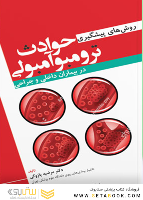 روش های پیشگیری حوادث ترومبوآمبولی در بیماران داخلی و جراحی