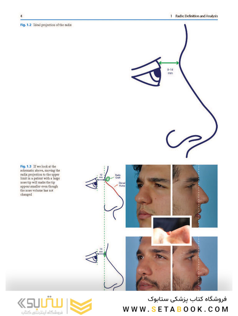 Photographic Atlas of Rhinoplasty : Problem-solving and Troubleshooting