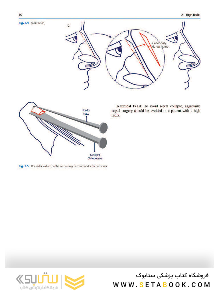 Photographic Atlas of Rhinoplasty : Problem-solving and Troubleshooting