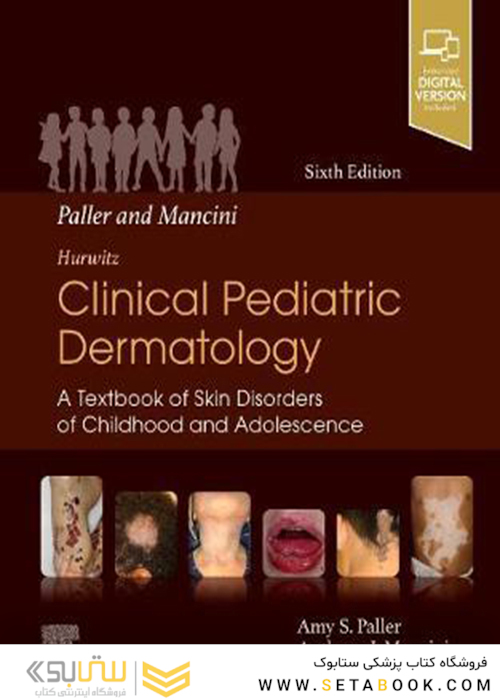 2021 Paller and Mancini - Hurwitz Clinical Pediatric Dermatology: A Textbook of Skin Disorders of Childhood - Adolescence
