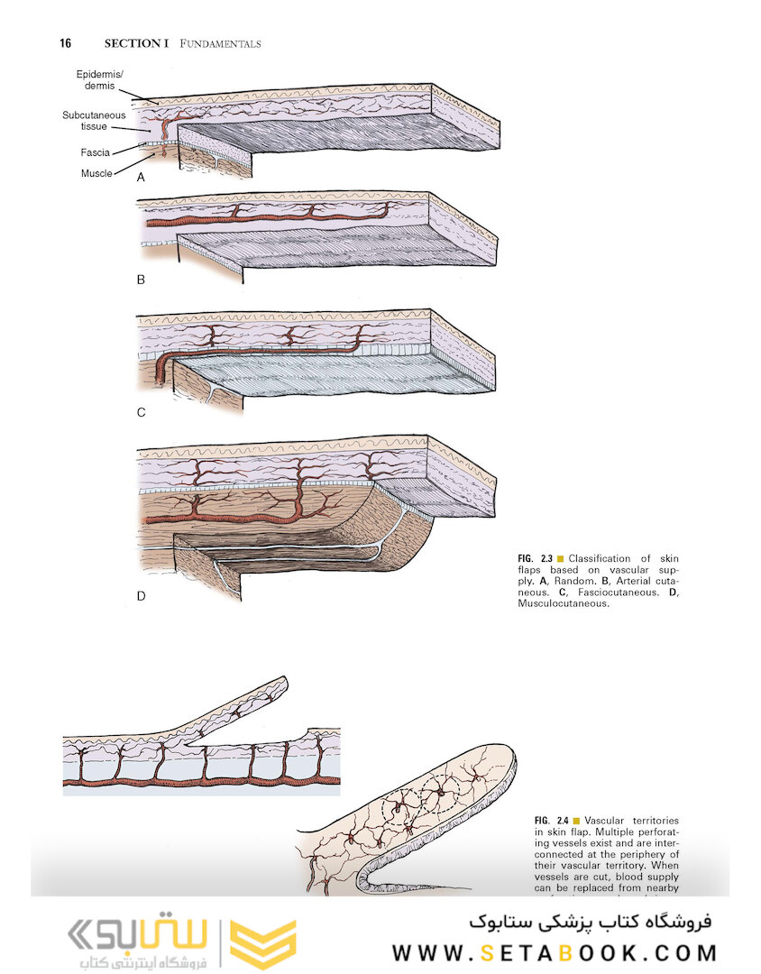 Local Flaps in Facial Reconstruction 2022