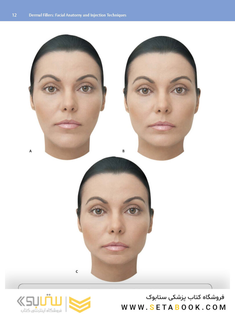 Dermal Fillers : Facial Anatomy and Injection Techniques2020