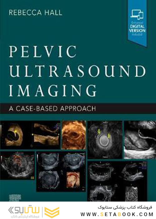Pelvic Ultrasound Imaging: A Cased-Based Approachتصویربرداری سونوگرافی لگن