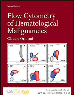Flow Cytometry of Hematological Malignancies