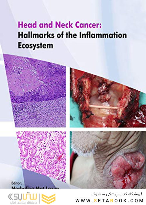 Head and Neck Cancer: Hallmarks of The Inflammation Ecosystem-Volume 2  2021 سرطان سر و گردن: نشانه های اکوسیستم التهاب-جلد 2