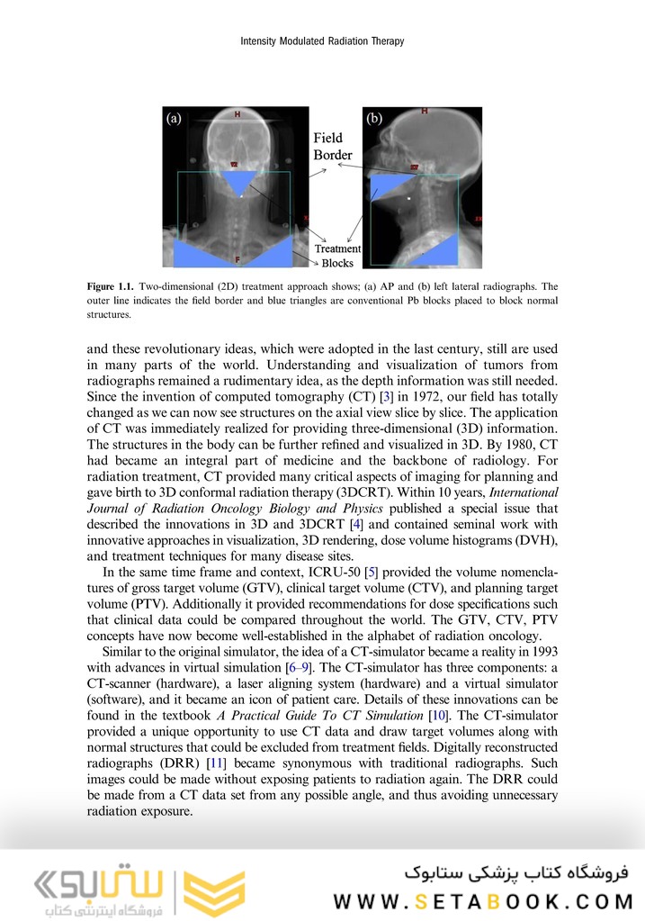 Intensity Modulated Radiation Therapy : A Clinical Overview 2021