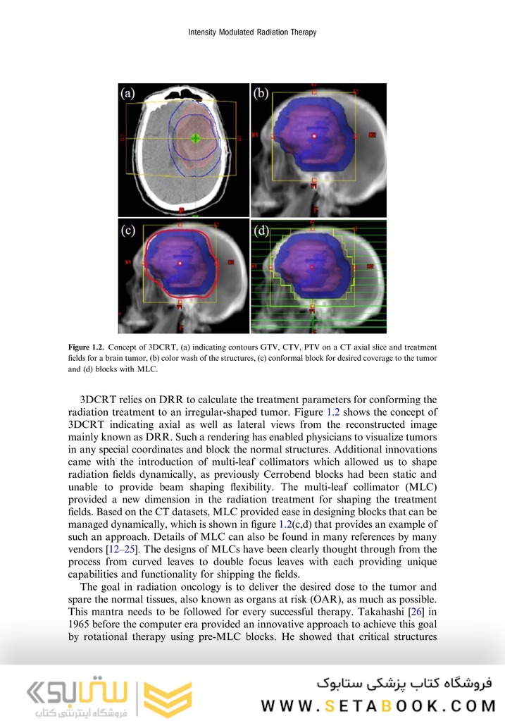 Intensity Modulated Radiation Therapy : A Clinical Overview 2021