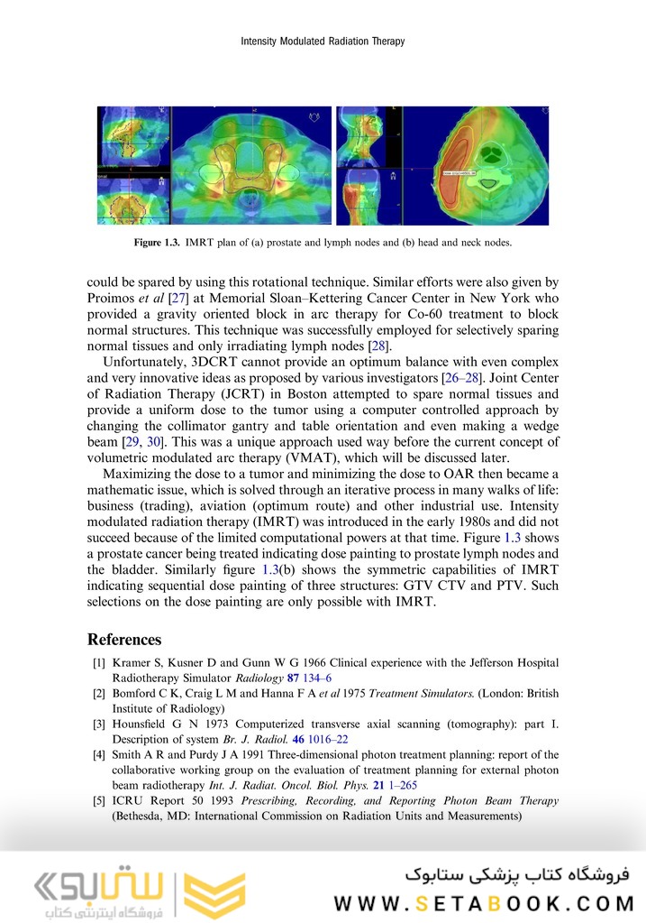 Intensity Modulated Radiation Therapy : A Clinical Overview 2021