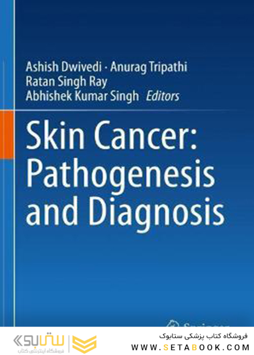 Skin Cancer: Pathogenesis and Diagnosis2021سرطان پوست