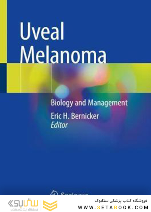 Uveal Melanoma: Biology and Management2021