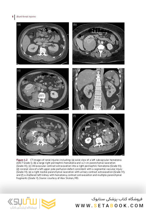 A Clinical Guide to Urologic Emergencies2021