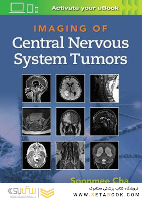 Imaging of Central Nervous System Tumors2021تصویربرداری از تومورهای سیستم عصبی مرکزی