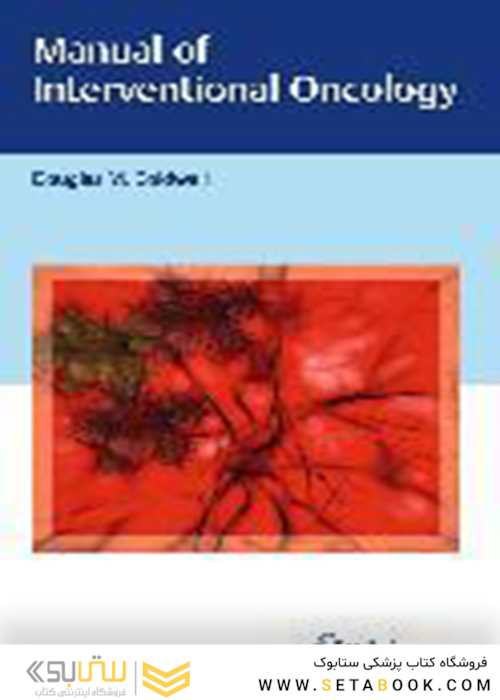 راهنمای انکولوژی مداخله ای