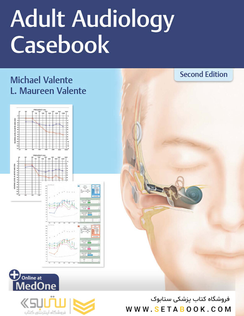 Adult Audiology Casebook 2nd Edicion