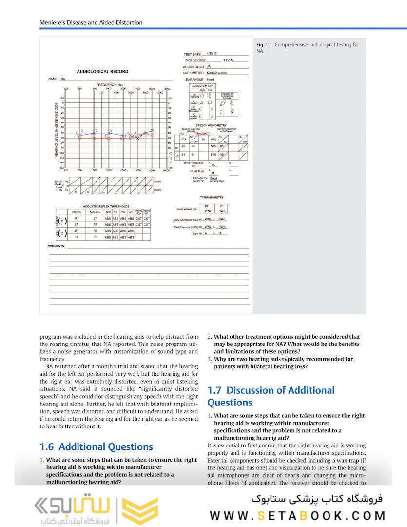 Adult Audiology Casebook 2nd Edicion