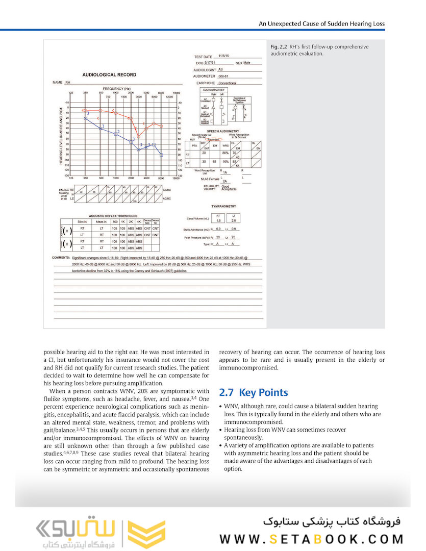 Adult Audiology Casebook 2nd Edicion