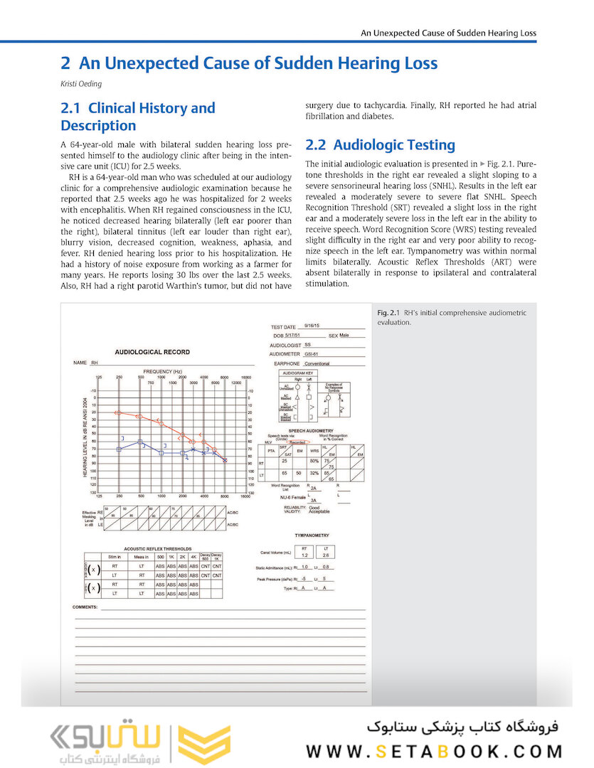Adult Audiology Casebook 2nd Edicion