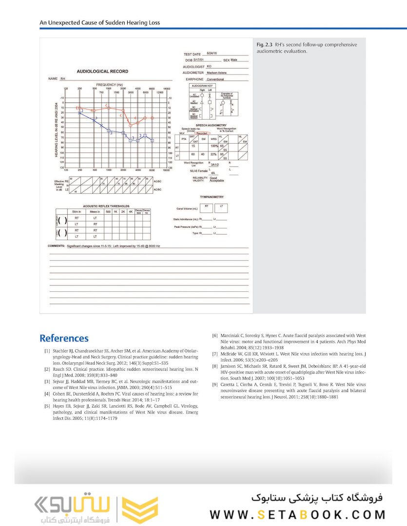 Adult Audiology Casebook 2nd Edicion