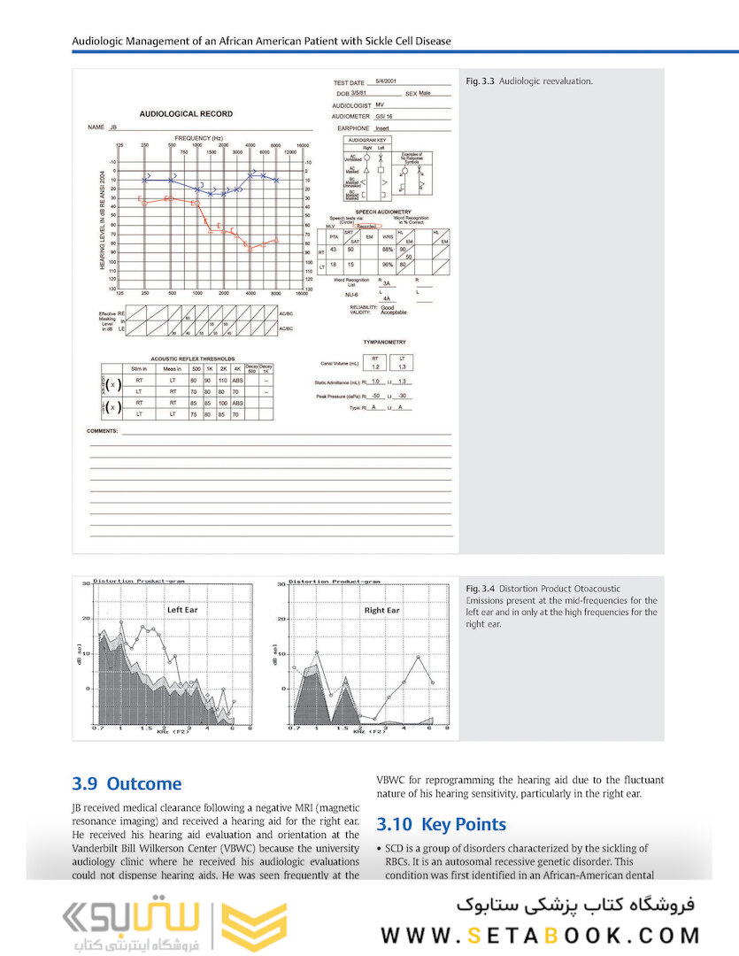 Adult Audiology Casebook 2nd Edicion