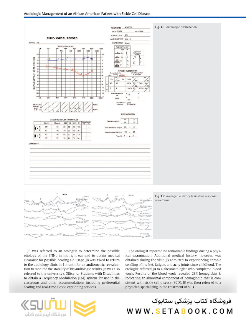 Adult Audiology Casebook 2nd Edicion