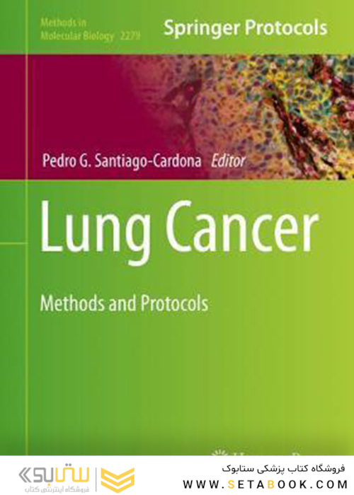 Lung Cancer: Methods and Protocols (Methods in Molecular Biology, 2279)