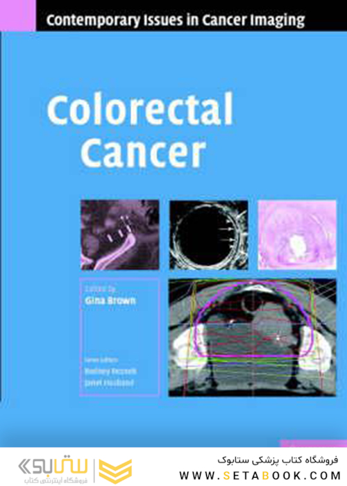 Colorectal Cancer2008سرطان روده بزرگ