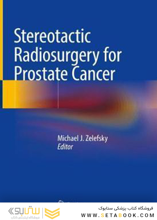 Stereotactic Radiosurgery for Prostate Cancer2018رادیو جراحی استریوتاکتیک برای سرطان پروستات