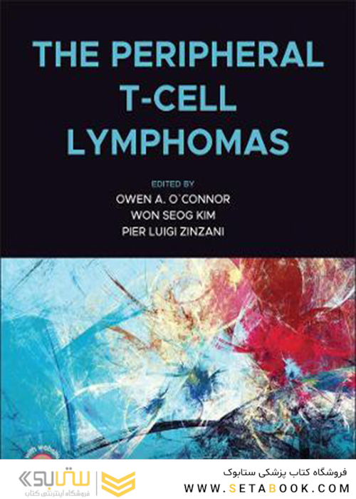 The Peripheral T-Cell Lymphomasلنفوم های سلول T محیطی