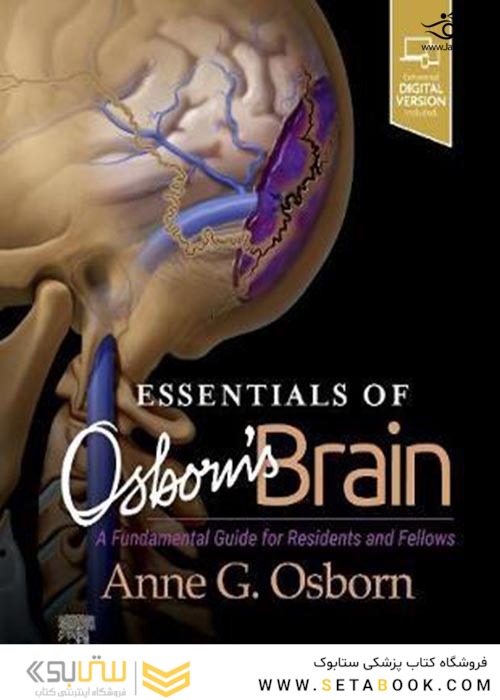 Essentials of Osborn