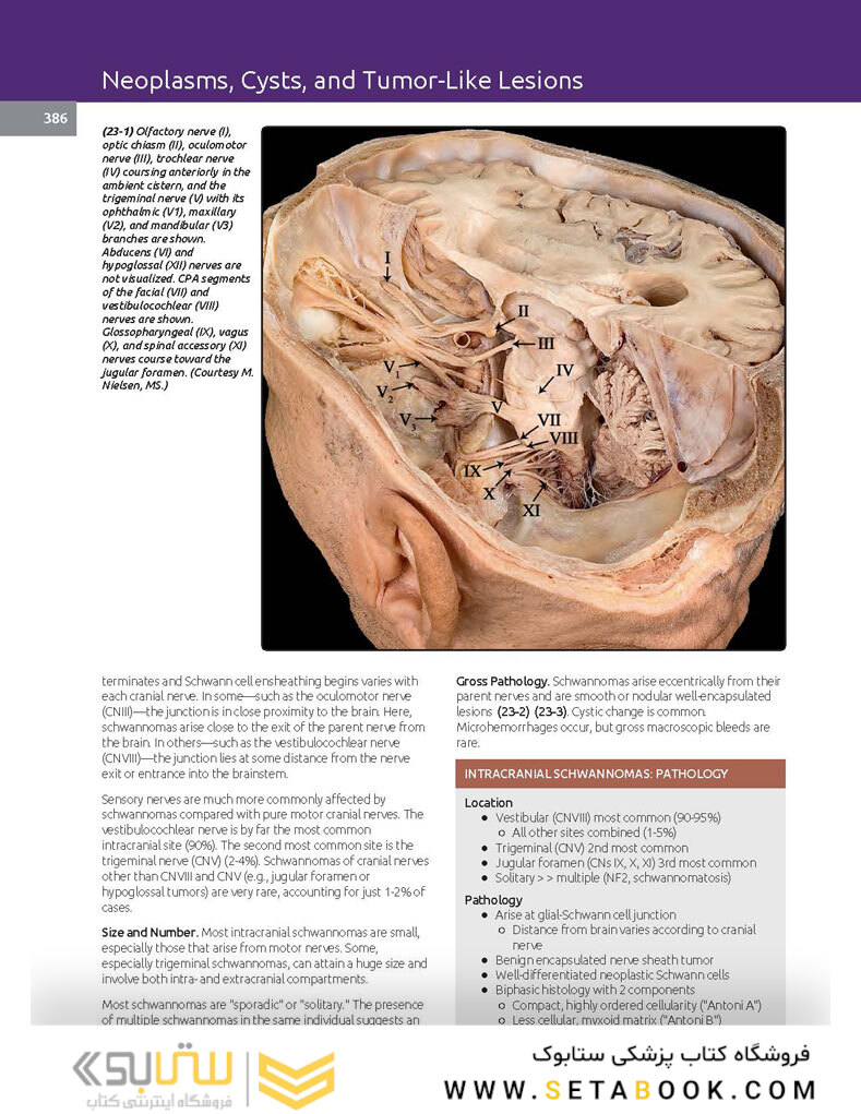 Essentials of Osborn