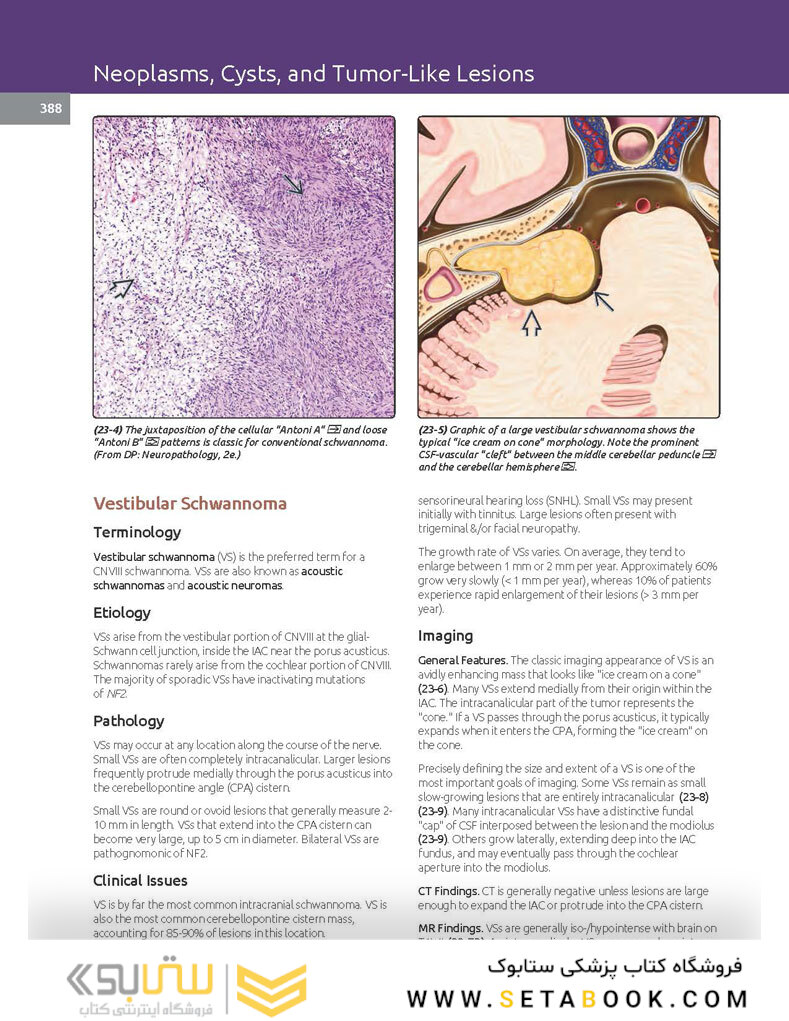 Essentials of Osborn